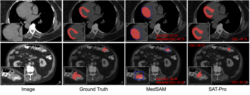 开源3D医学大模型SAT，支持497类器官，性能超越72个nnU-Nets，上交大团队发布